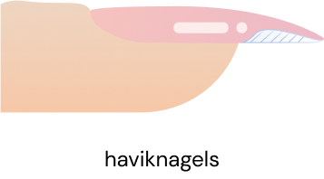 haviknagels