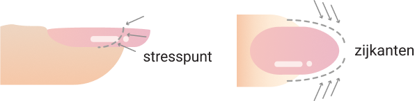Stresspunt en zijkanten